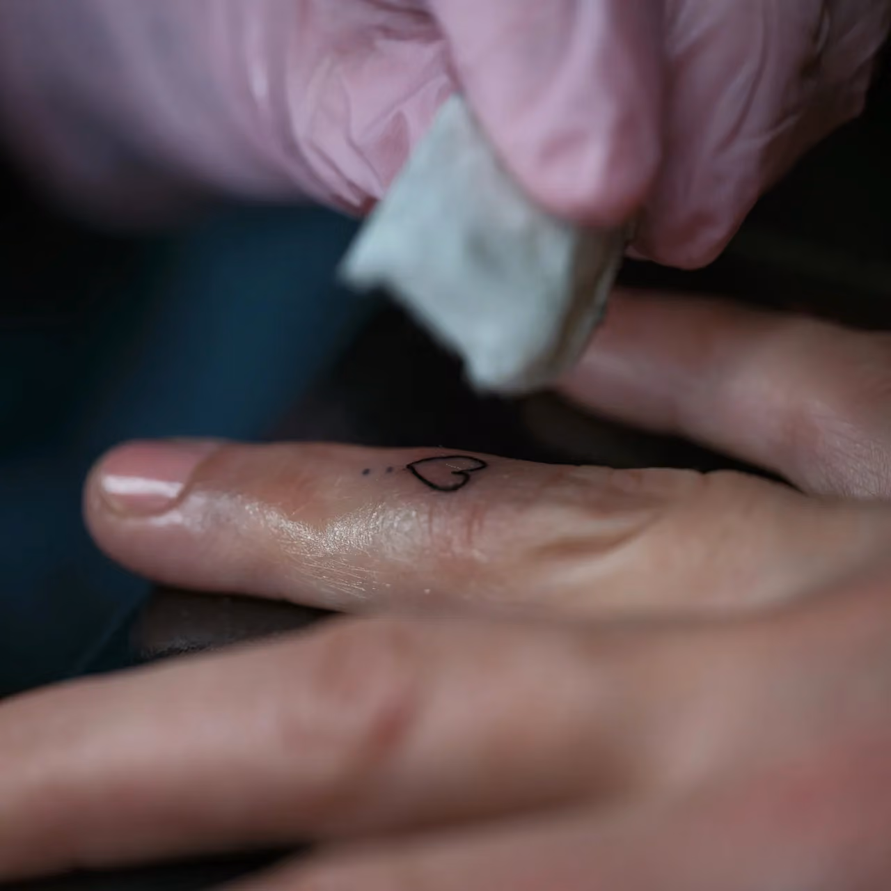 PicoSure Pro Laser Treatment for Tattoo Removal