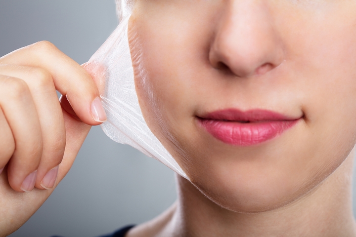 5 Chemical Peel Benefits for Skin Care