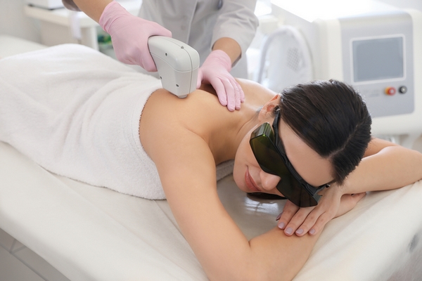 6 Best Benefits of Laser Hair Removal Procedures