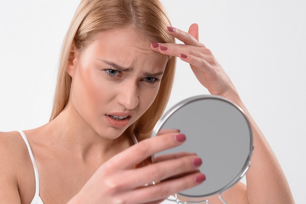 Fine lines and wrinkles are part of the dehydrated skin symptoms.