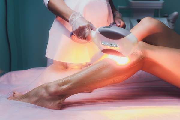 Use the IPL treatment to improve skin texture.