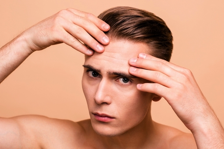 6 Most Common Causes of Wrinkled Skin