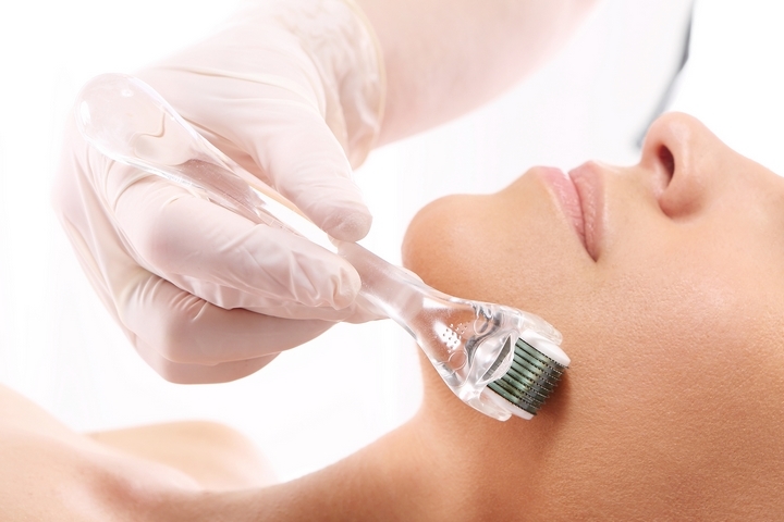 6 Microneedling Benefits and Their Positive Effects