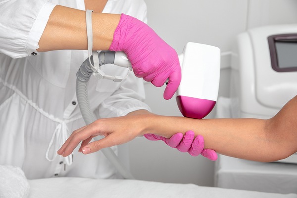 IPL is the beat treatment for aging hands.