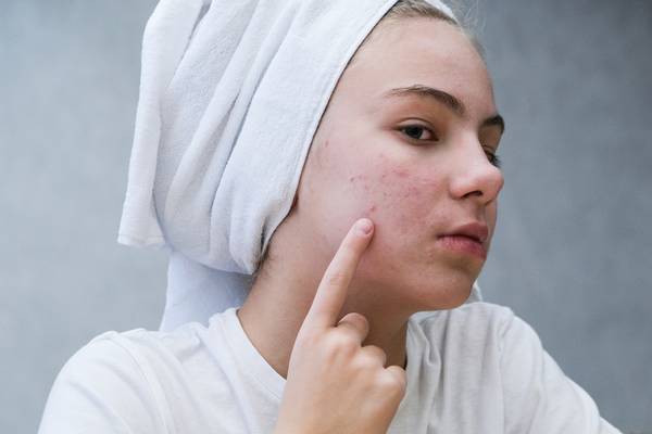 Do not touch your face acne.