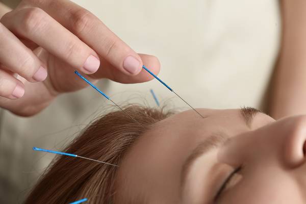 Acupuncture is one of the best treatments for deep forehead wrinkles.