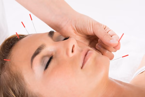 Use cosmetic acupunture for wrinkles around mouth.