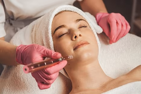 Microneedling1