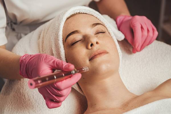 What to Do Before Microneedling Treatments