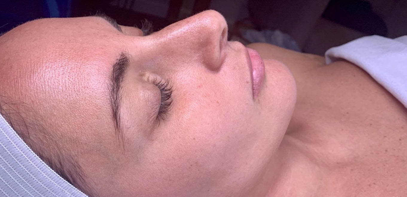 Hydrafacial Treatments