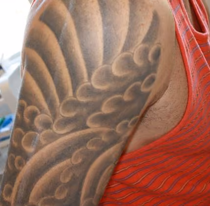 Laser Tattoo Removal