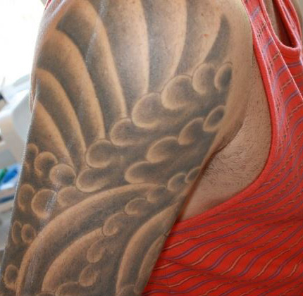 Laser Tattoo Removal