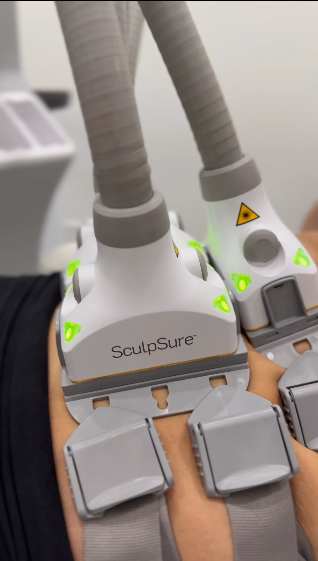 SculpSure