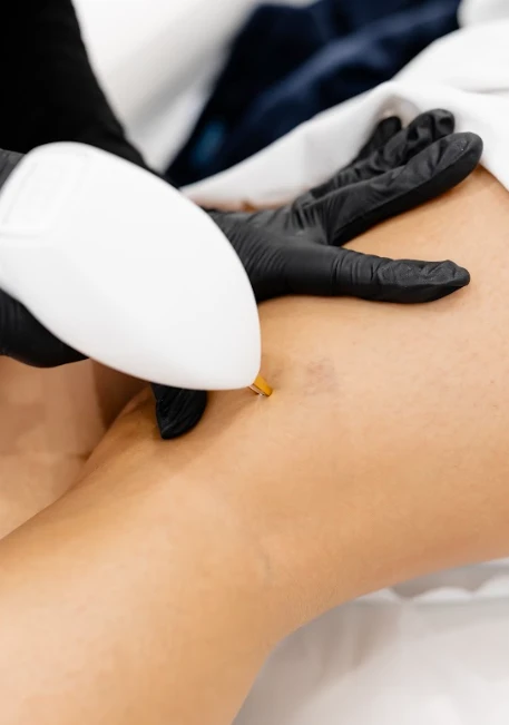 Vasculaze
