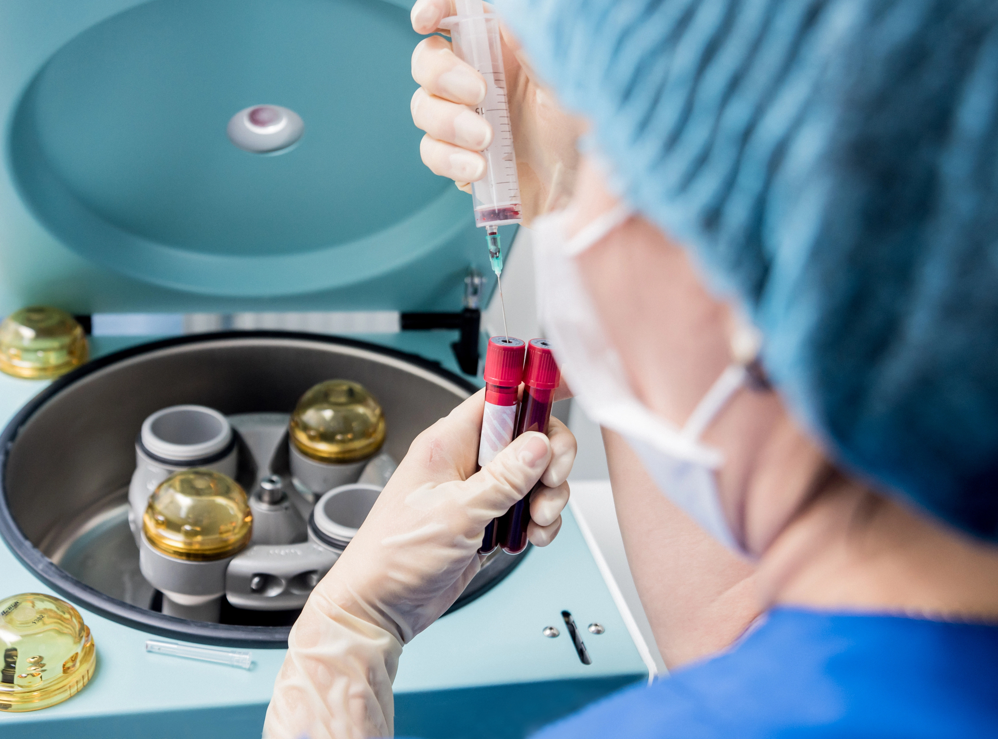 Healthcare professional preparing a platelet-rich plasma (PRP) treatment for regenerative aesthetics using a centrifuge and blood sample.