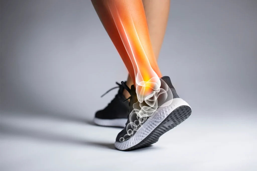 Arthrose Sprunggelenk – Was tun?