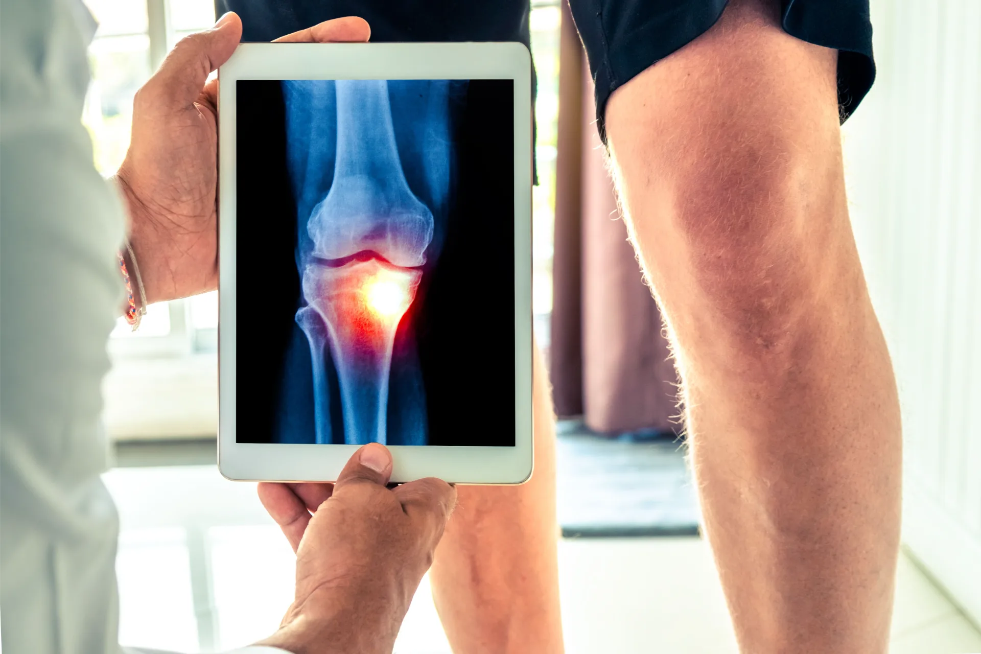 Studie bestätigt Wirkung der Stoßwellentherapie bei Kniearthrose
