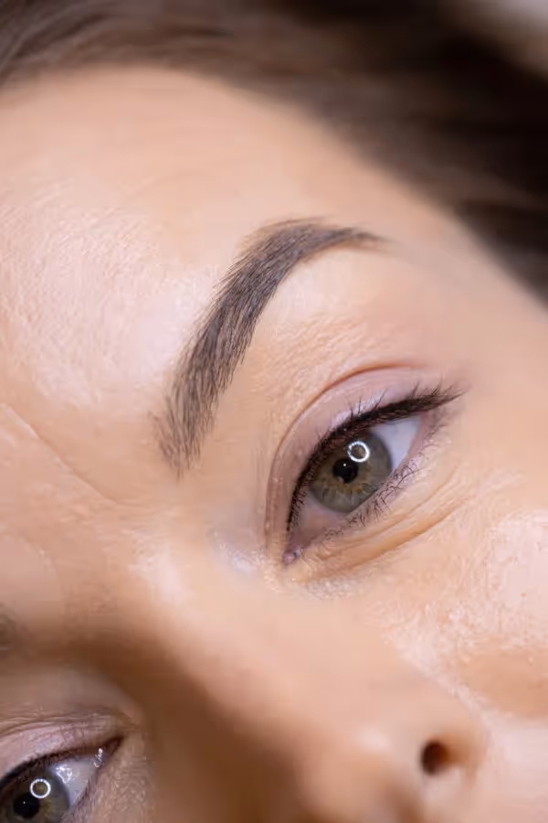 Semi-permanent lash line treatment