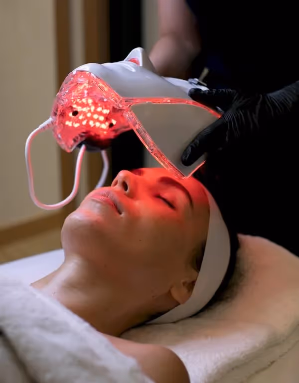 Microneedling treatment with LED-light add-on