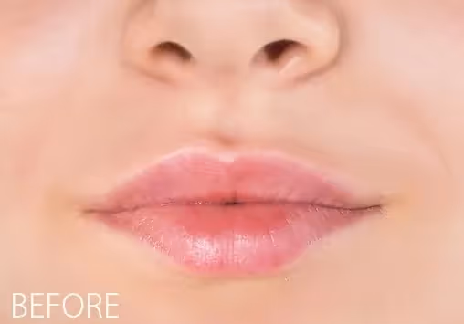 The Lip Blush treatment is a semi-permanent procedure that enhances your natural lip color with a soft, sheer tint. It adds subtle definition to your lips, helping to correct asymmetry and softly defines the lip line while giving a fuller, more polished appearance. This is a two-appointment process, with a follow-up recommended 4-12 weeks after the initial session to assess healing and refine the results as needed.