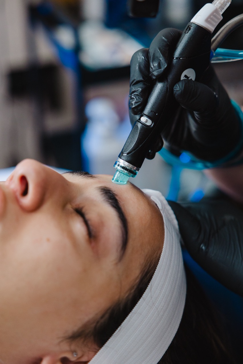 HydraFacial vs. Microneedling: Which Treatment Fits Your Skin Best?