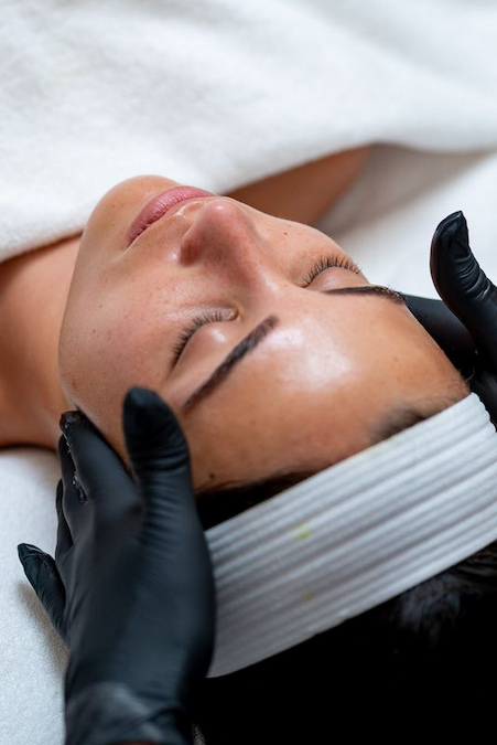 Skin glow post BioRePeel treatment