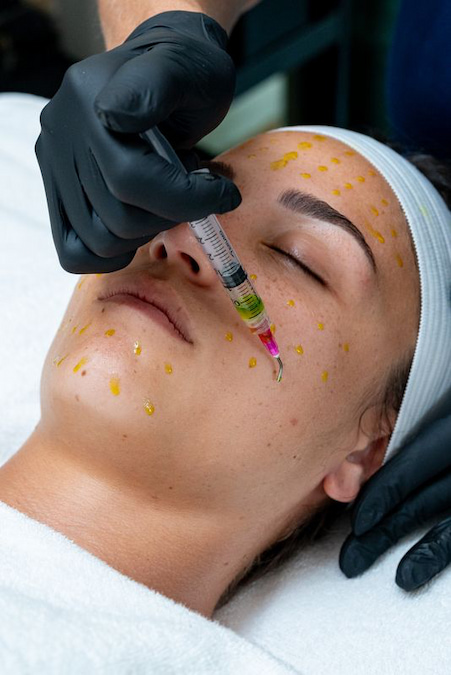 Applying BioRePeel solution