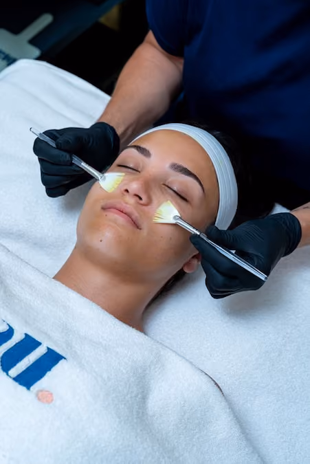 BioRePeel peeling procedure