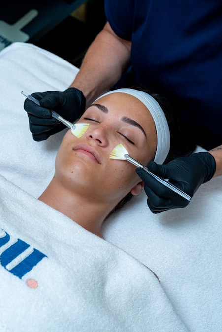 BioRePeel peeling procedure