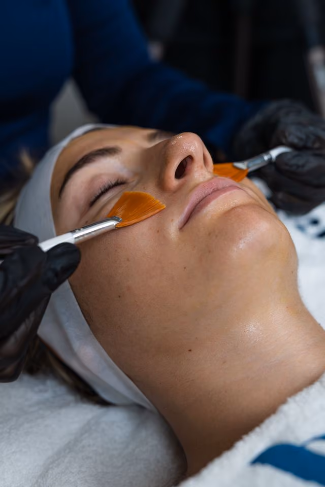 BioRepeel vs. Chemical Peel: Which One Is Right for You?
