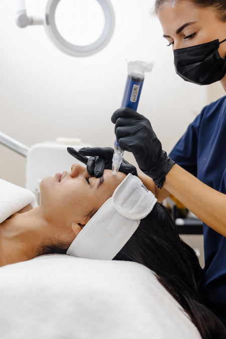 Mesotherapy treatment for hyperpigmentation