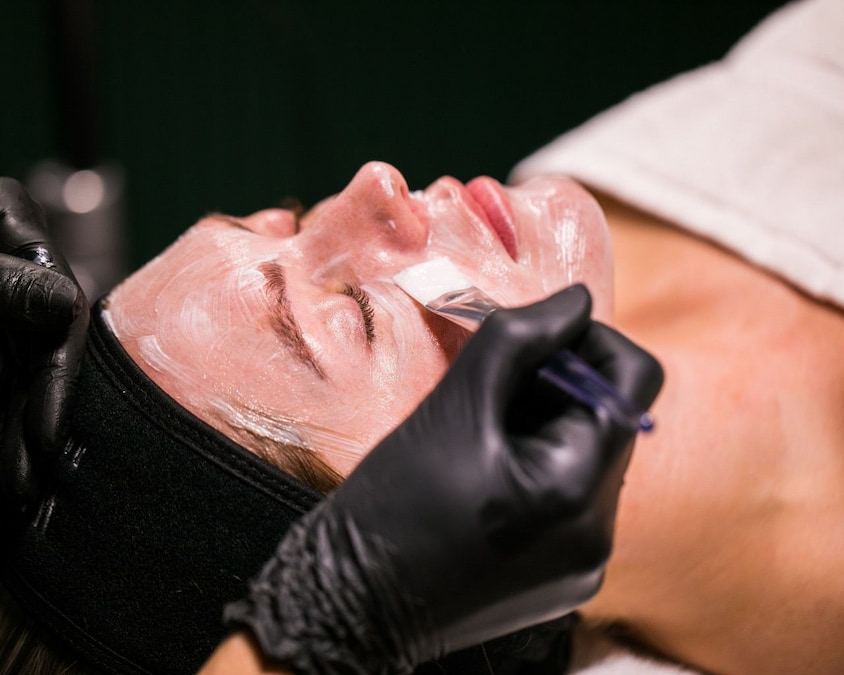 Applying peeling solution during Million Dollar Peel facial