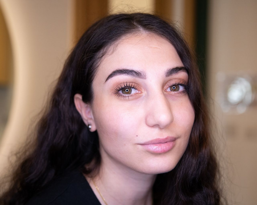 Semi-permanent beauty spot results