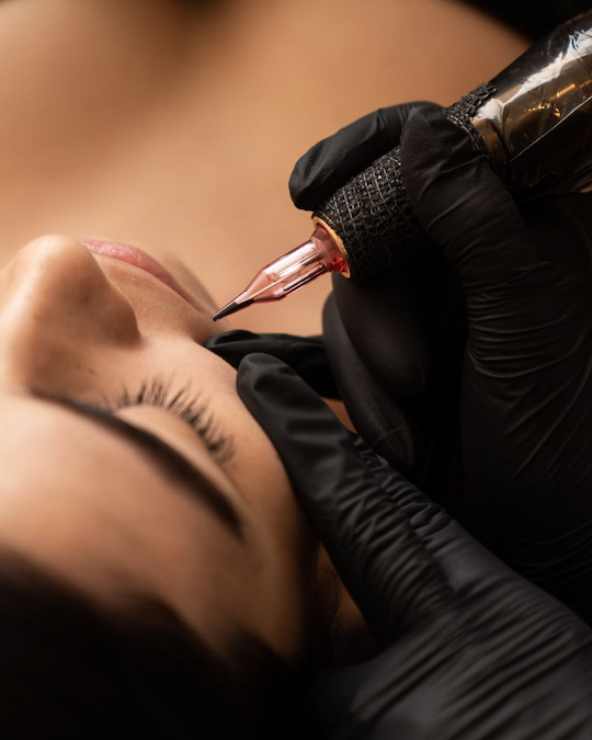 Micropigmentation pen depositing pigment during a beauty spot treatment