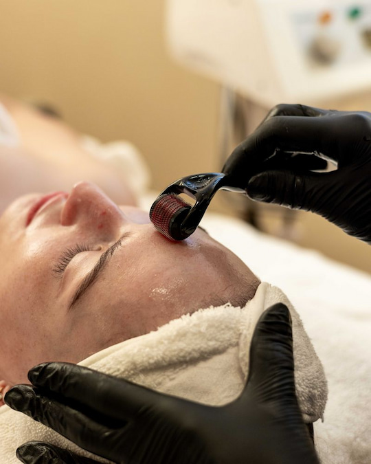 Skin treatment in progress at Brau