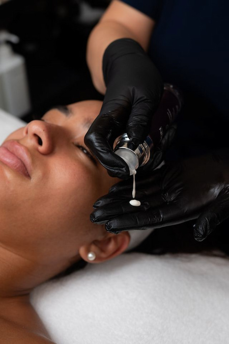 Serum being applied to the skin during a microneedling treatment