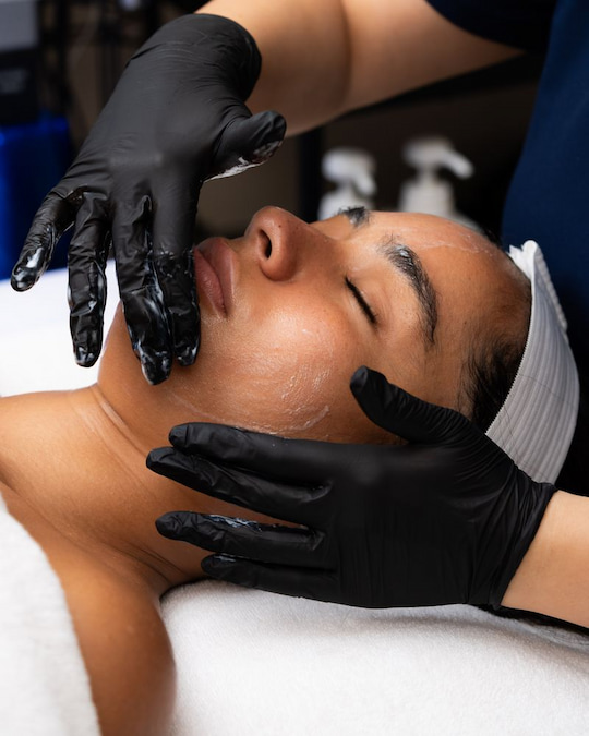 Serum applied to the face during microneedling treatment
