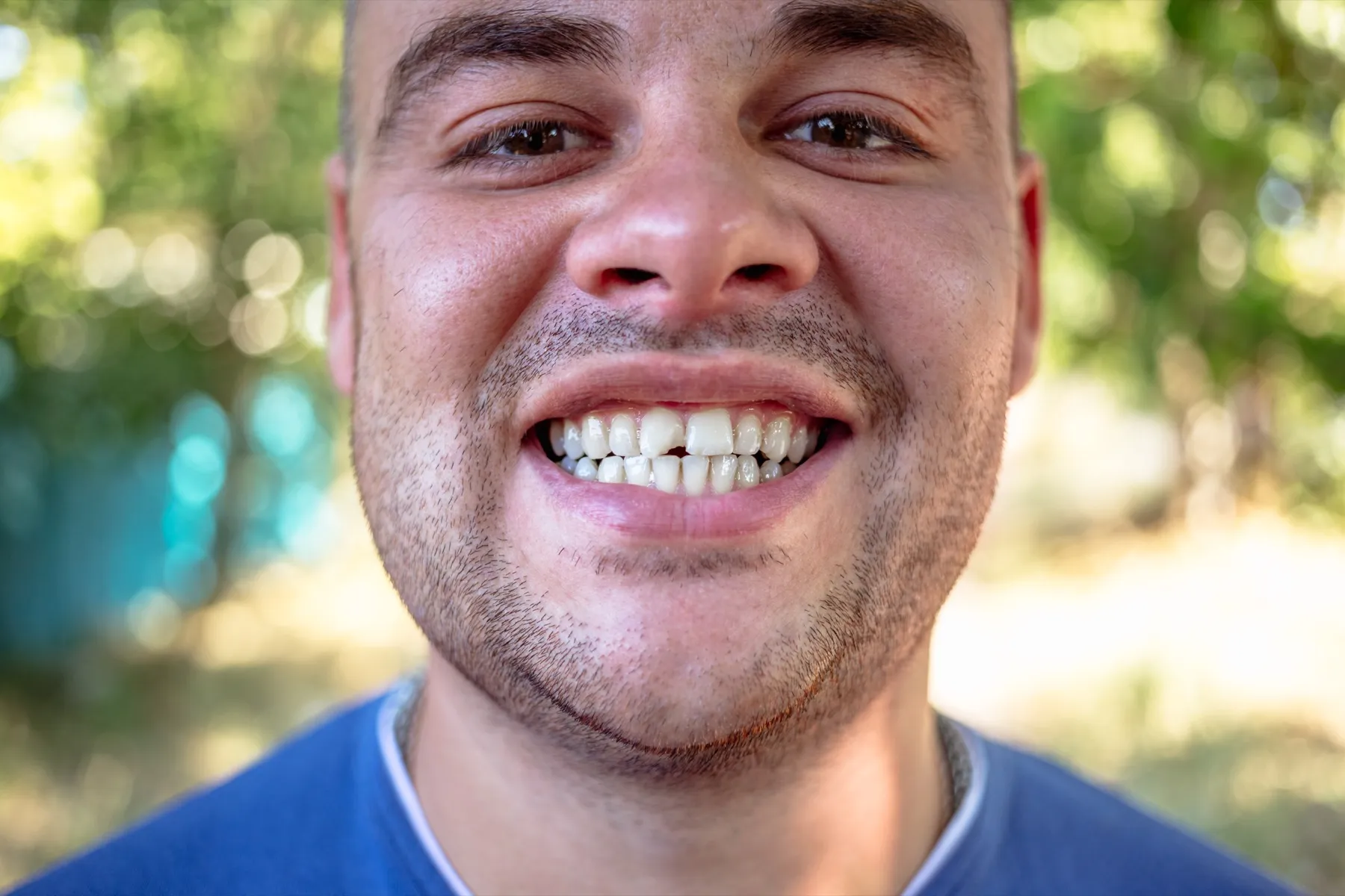 A close up of a man with a toothbrush in his mouth