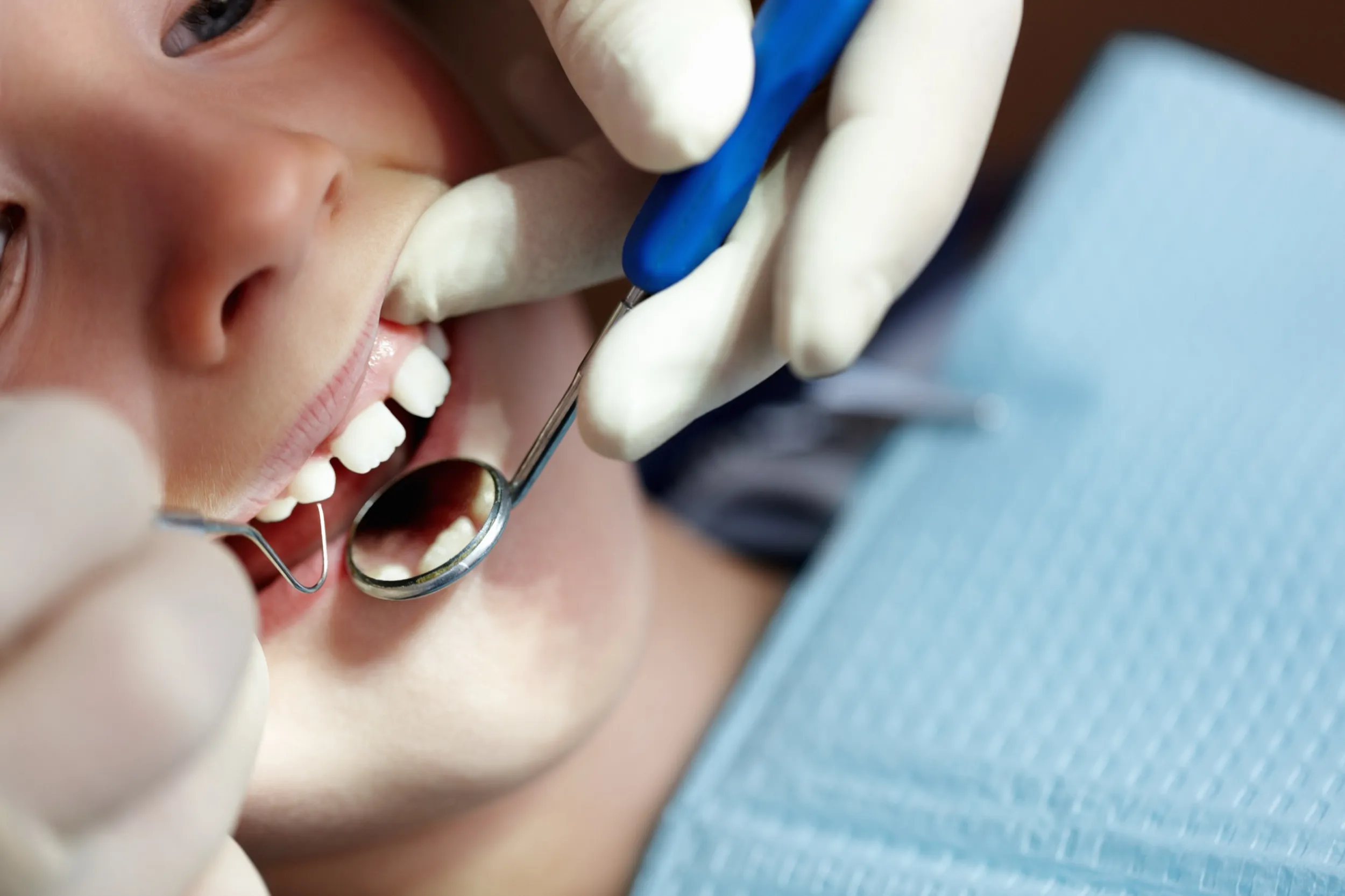 Dental examination with mirror, gloved hands checking teeth