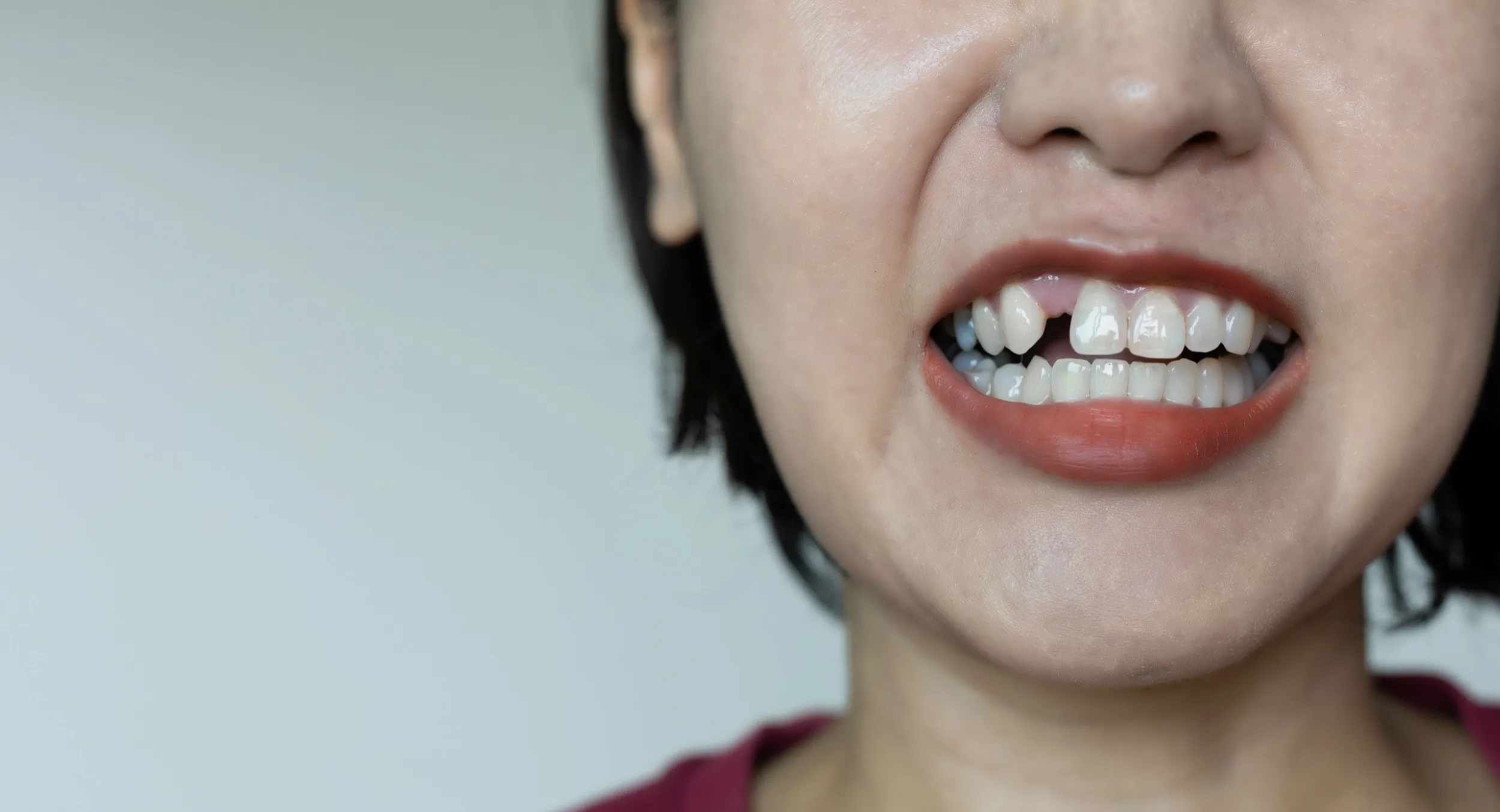 Closeup of bright white teeth and red lips against light background