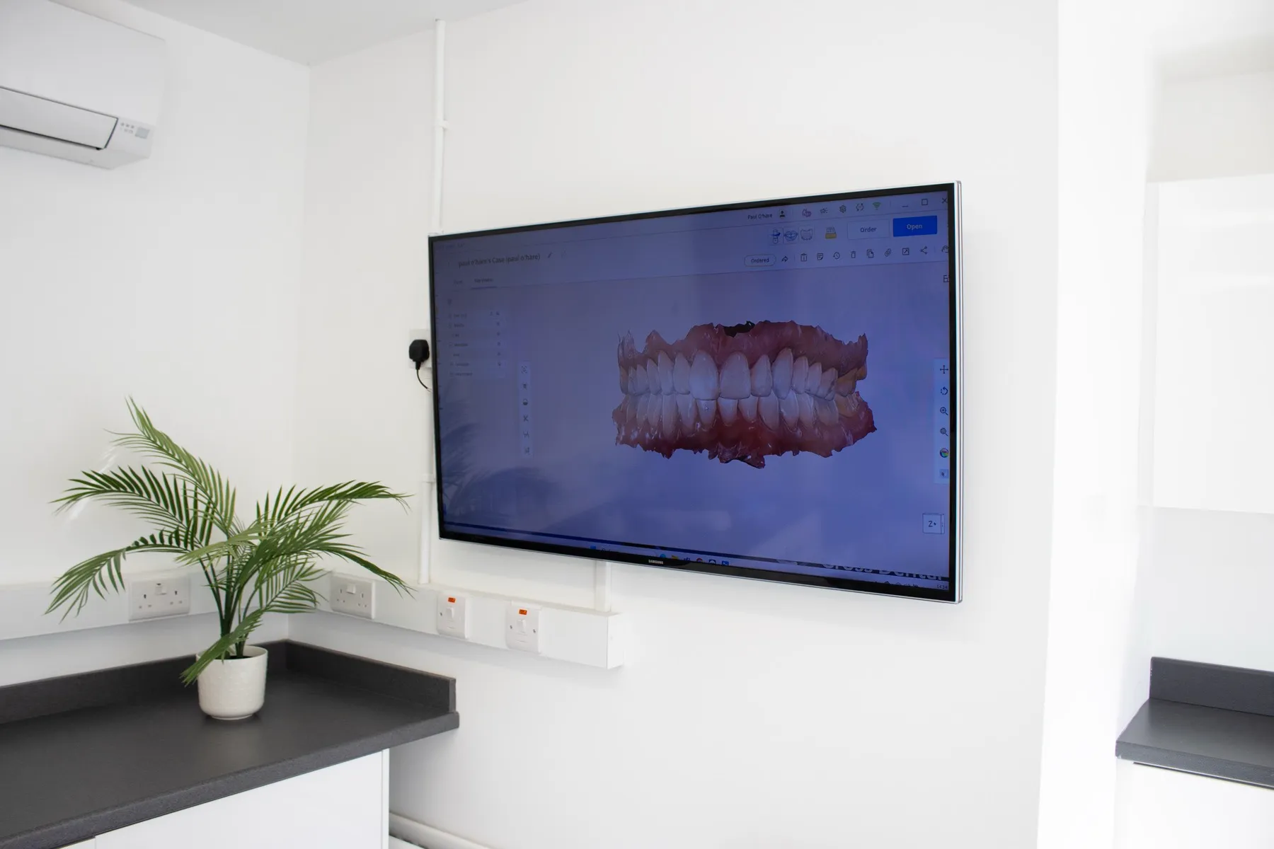 3D dental scan of teeth displayed on large monitor in modern office