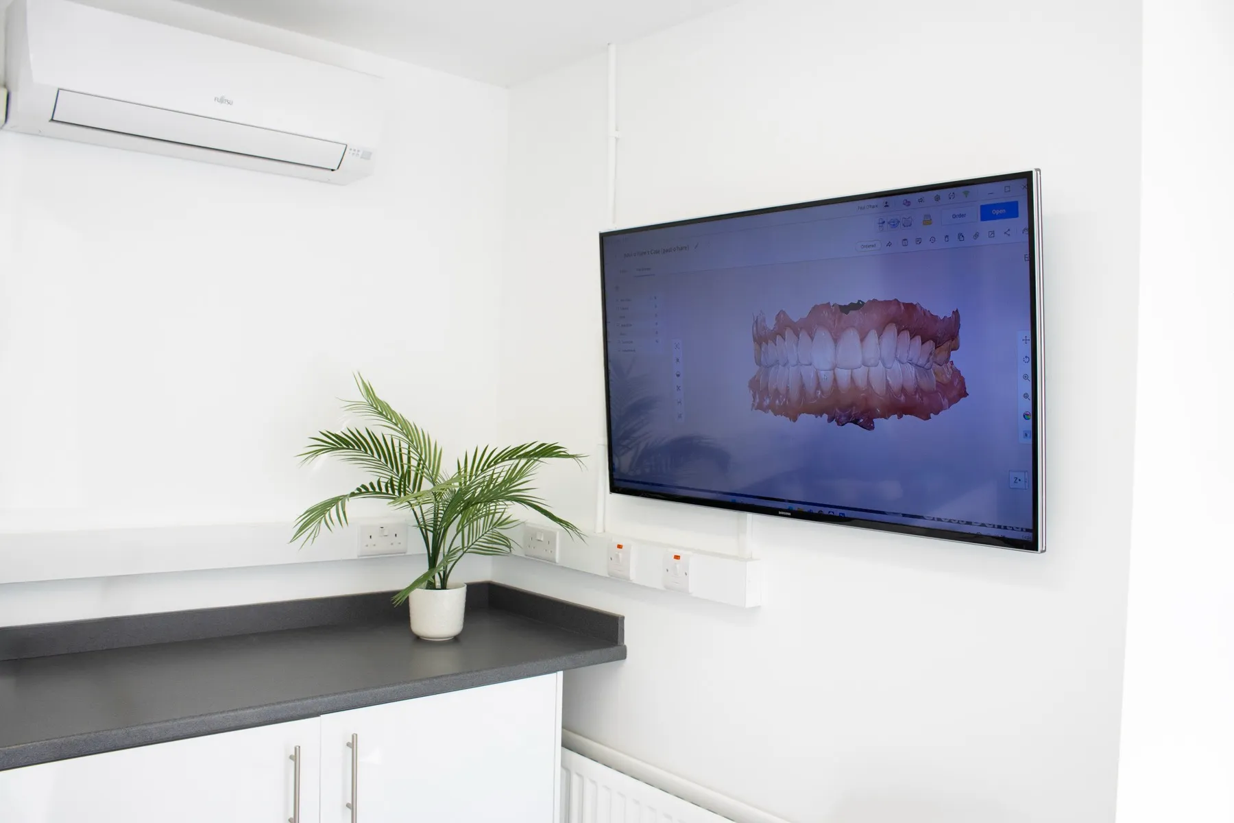 Dental office with 3D teeth model on screen and palm plant
