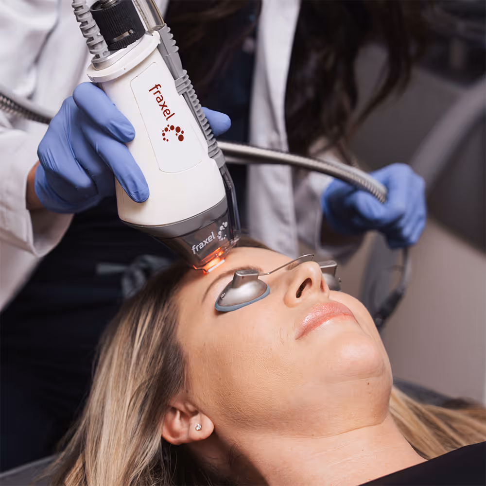 Patient is receiving Fraxel treatment after asking about Ultherapy in Corte Madera, CA