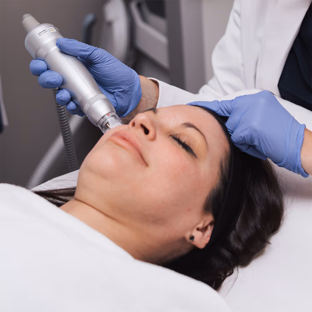 Patient receiving Scarlet treatment on cheek after learning about IPL Photofacial in Corte Madera, CA