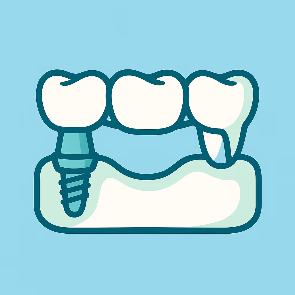 Understanding Dental Code D6068 – Abutment supported retainer for porcelain/ceramic fpd