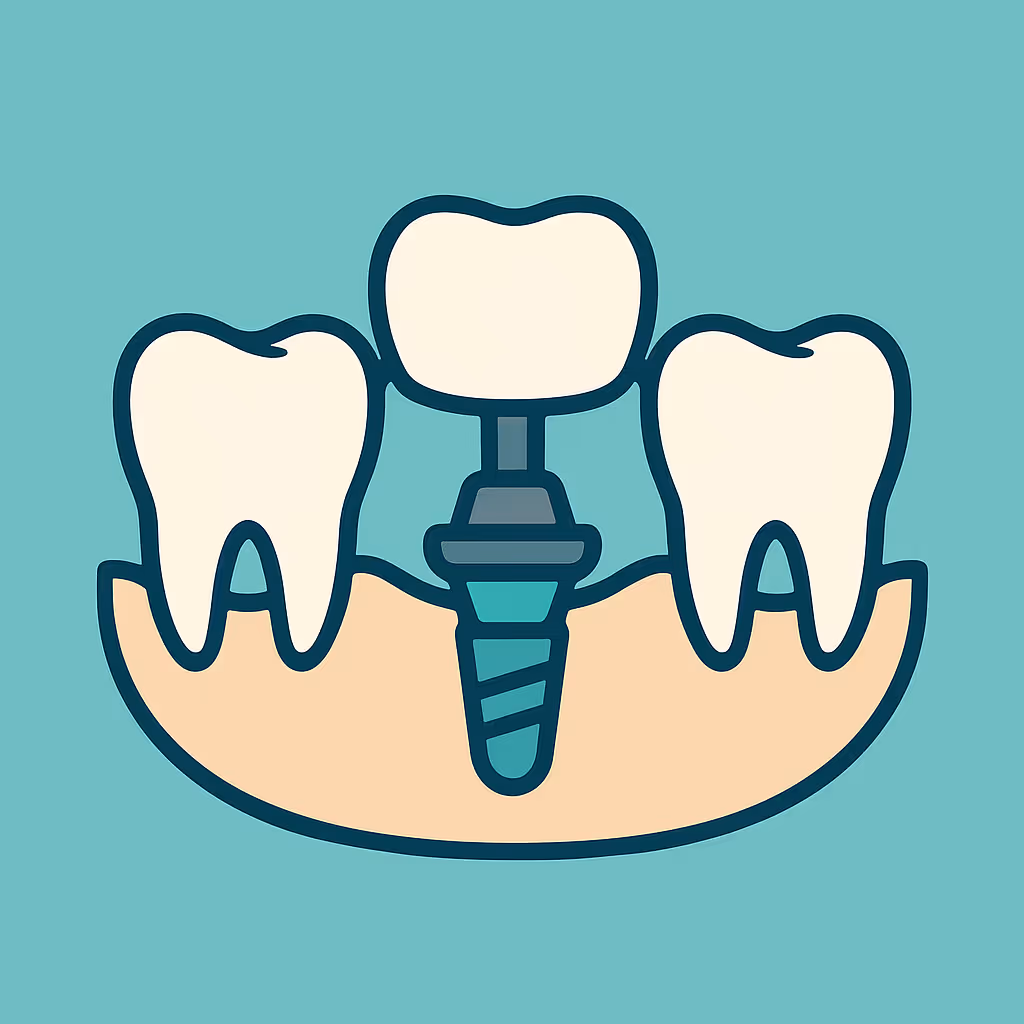 Understanding Dental Code D6069 – Abutment supported retainer for porcelain fused to metal fpd (high noble metal)
