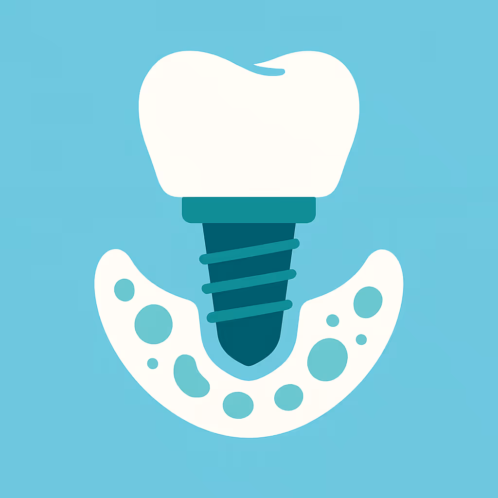 Understanding Dental Code D6104 – Bone graft at time of implant placement