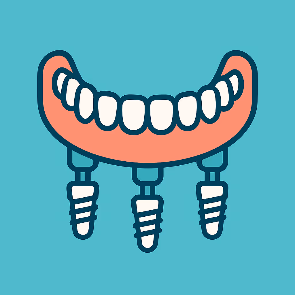 Understanding Dental Code D6111 – Implant /abutment supported removable denture for edentulous arch – mandibular