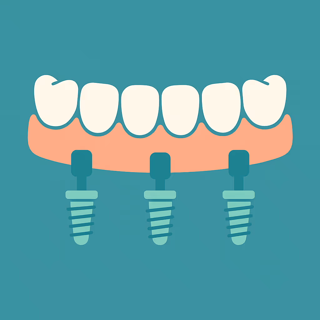 Understanding Dental Code D6117 – Implant /abutment supported fixed denture for partially edentulous arch – mandibular