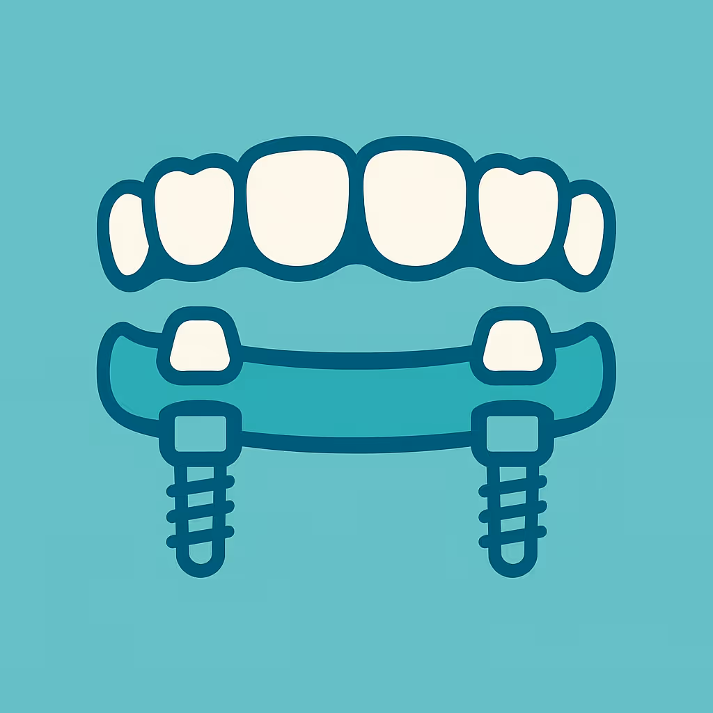 Understanding Dental Code D6116 – Implant /abutment supported fixed denture for partially edentulous arch – maxillary
